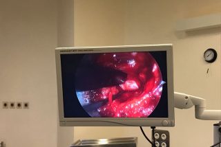 Cirugia Endoscopica de columna 3